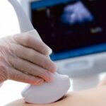 稽留流産後は妊娠しやすい